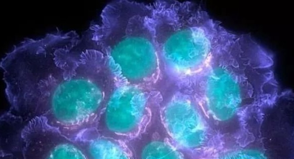 Ӣ����֢�о����Ľ����о���������������ϸ����������δ���ΰ����ţ�